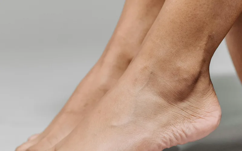 Arch Pain Treatment treatment at Bends Foot and Ankle in Chillicothe, Ohio