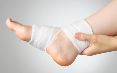 A patient's foot and ankle wrapped in a white compression bandage